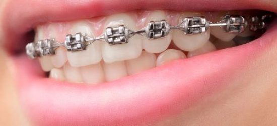 ortodoncia -clinica dental molina de aragon